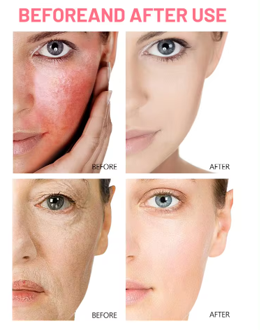 SERUM PARA OJOS CAPSULA APLICABLE