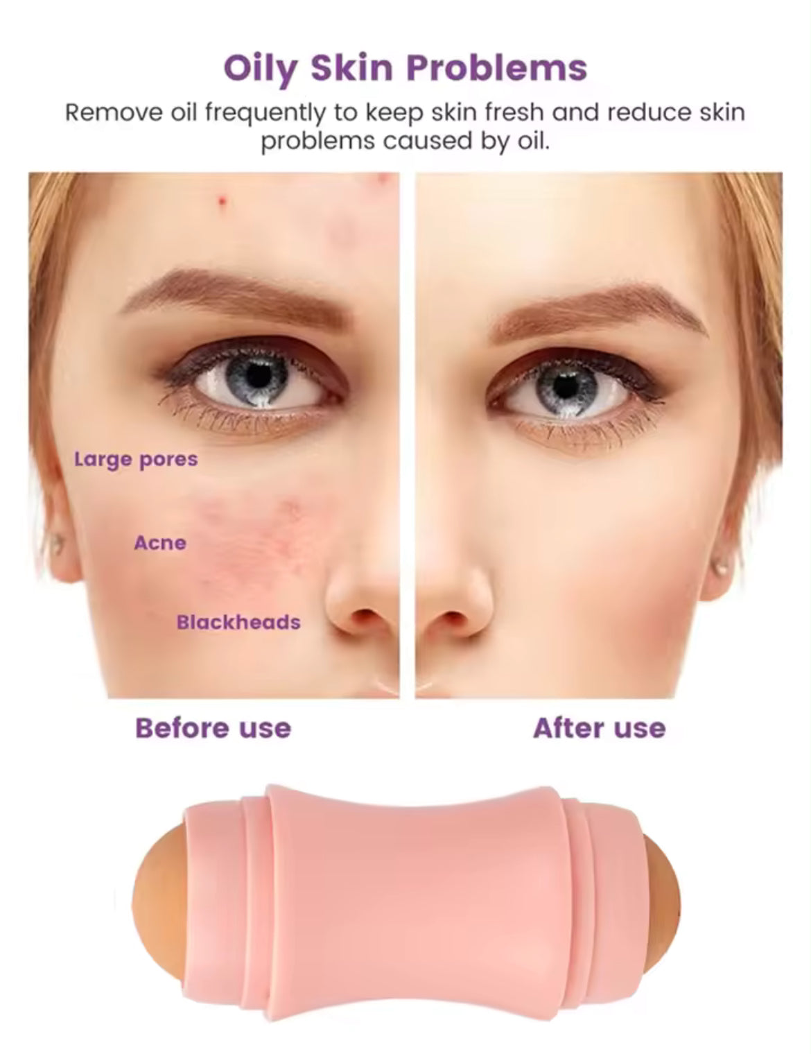 Rodillo absorbente facial
